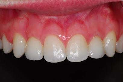 Smile Design