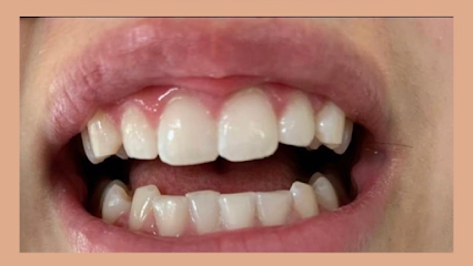 The Teeth Whitening Lab