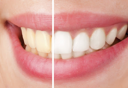 Sparklewhite Teeth