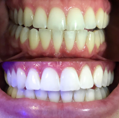 Sparkling White Smile